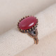 Pembe Kedi Gözü Taşlı Otantik Yüzük